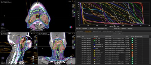 External Beam Planning Screen Shot